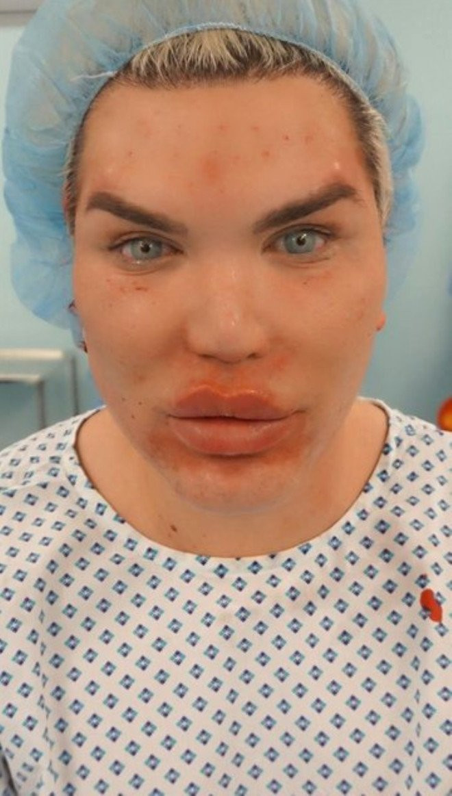 Rodrigo Alves’in son hali şaşkınlık yarattı - Resim : 1