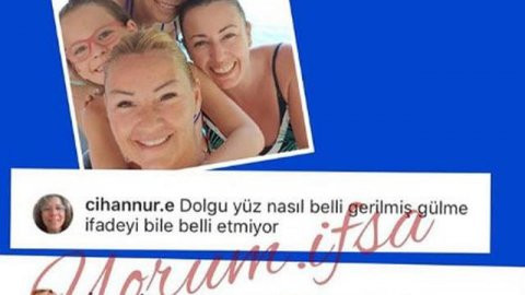 Pınar Altuğ'dan 'dolgu yüz' yorumuna sert cevap - Resim : 1