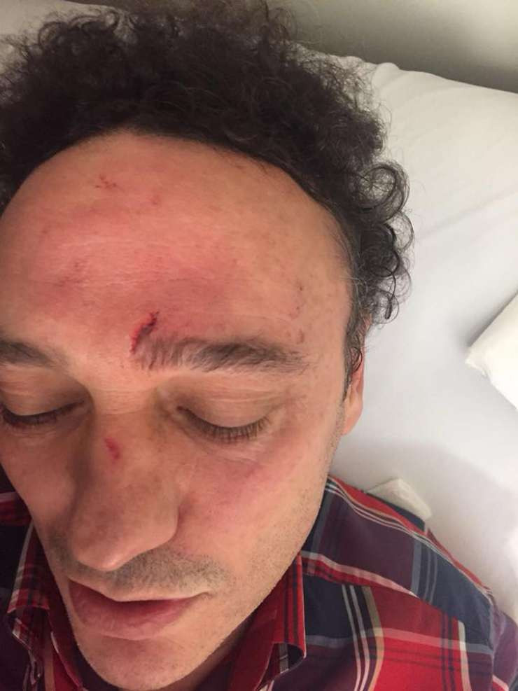 Bir saldırı da İstanbul'dan: Doktor kafa travması geçirdi - Resim : 1