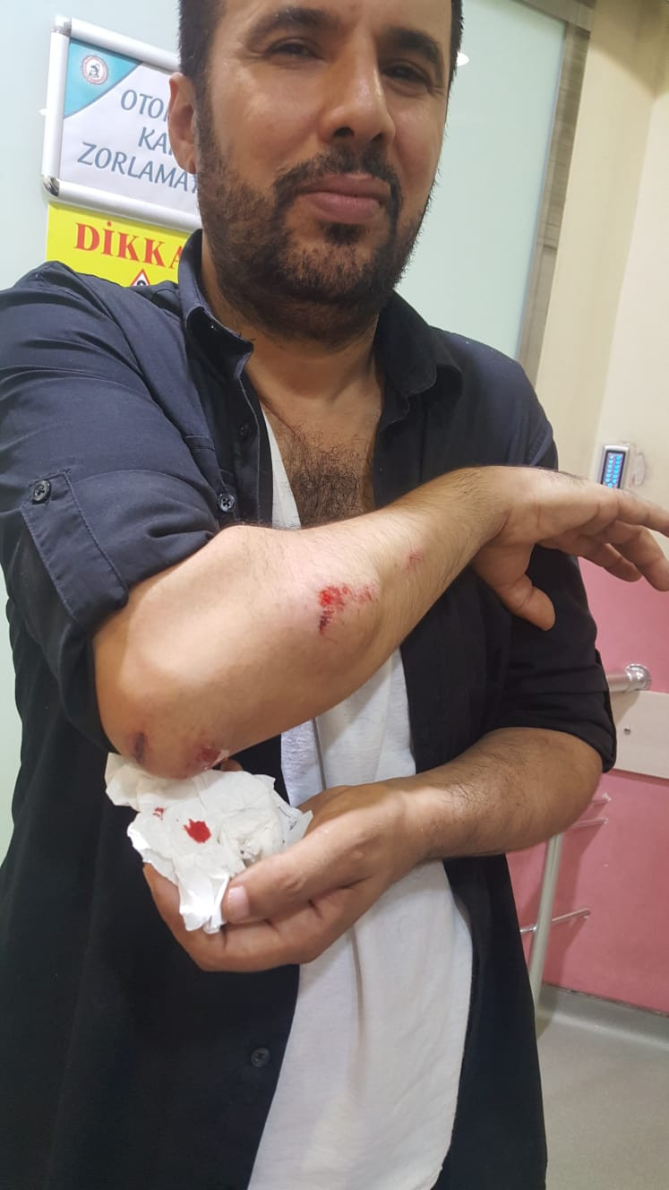 Cumartesi Anneleri'ne polis müdahalesi! Aydın Aydoğan’ın kolu kırıldı - Resim : 1