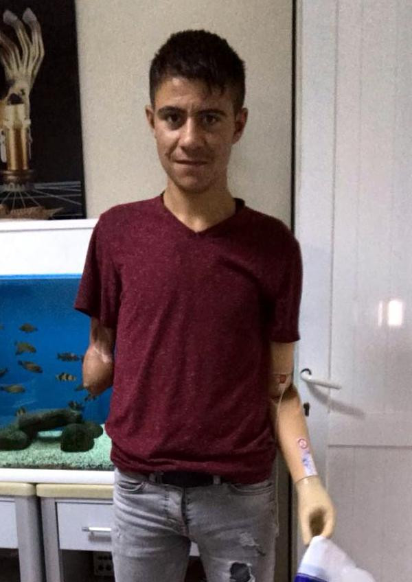 Kuşu kurtarırken ellerinden olan Ramazan'a protez kol takıldı - Resim : 1