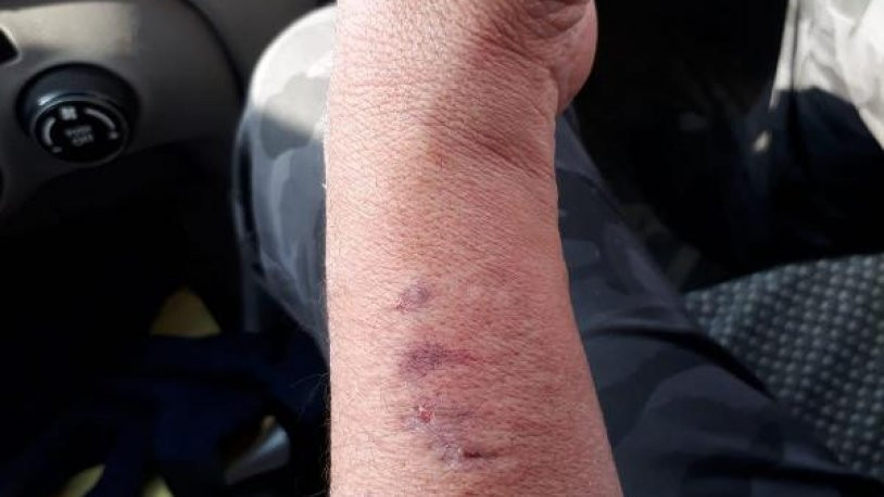 Kadın polisin kolunu ısıran HDP'li vekile soruşturma - Resim : 1