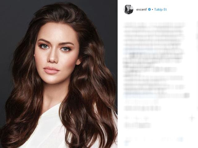 Bebeğini kucağına alan Fahriye Evcen, reklam yüzü oldu! - Resim : 1