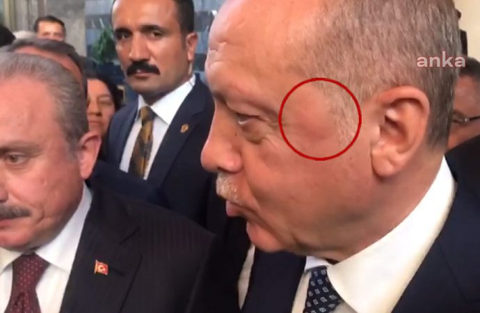 Erdoğan'ın yüzünde dikkat çeken ayrıntı - Resim : 1