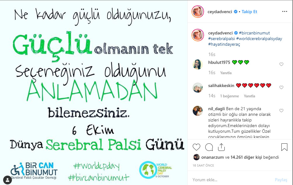 Ceyda Düvenci'den serebral palsi paylaşımı - Resim : 1