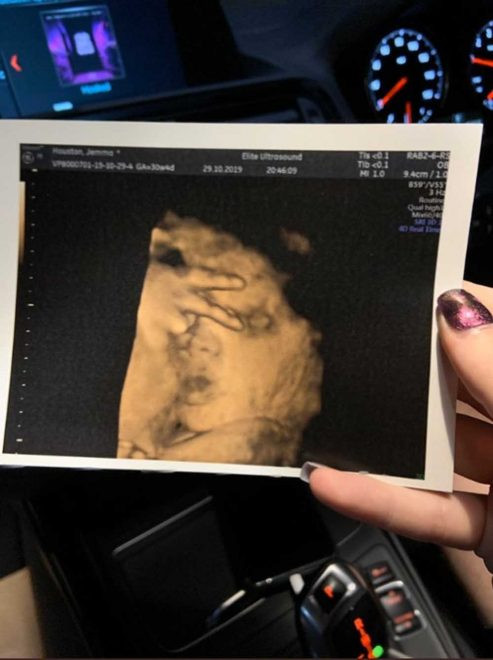 Hamile kadın ultrason sonucunu görünce gözlerine inanamadı - Resim : 1