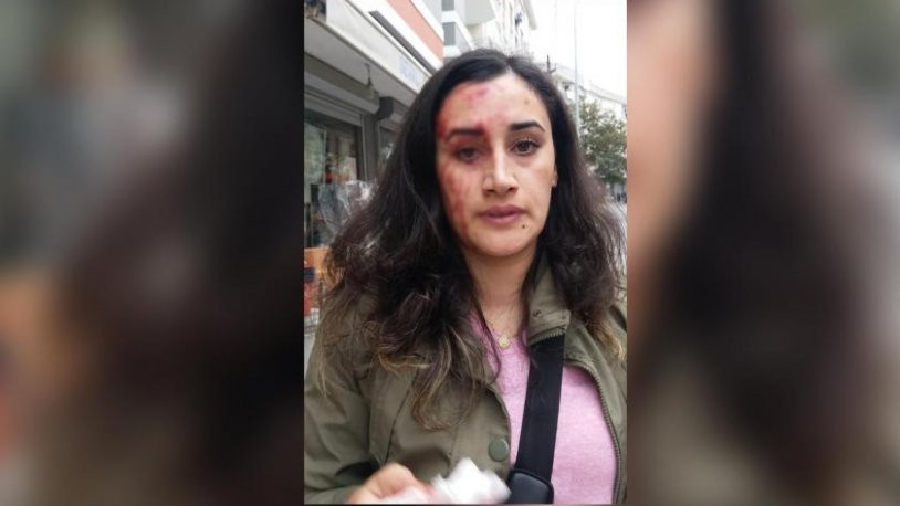 Cihan Tekstil'in patronu Şükrü Üner, tazminatını ödemeden attığı kadın işçiye saldırdı - Resim : 1