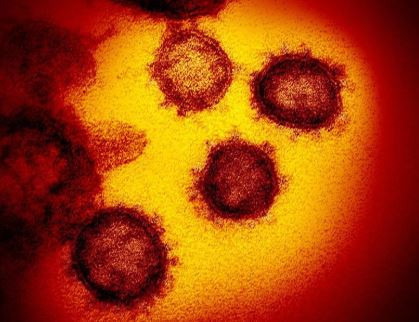 Koronavirüsün yeni görüntüsü yayımlandı - Resim : 2