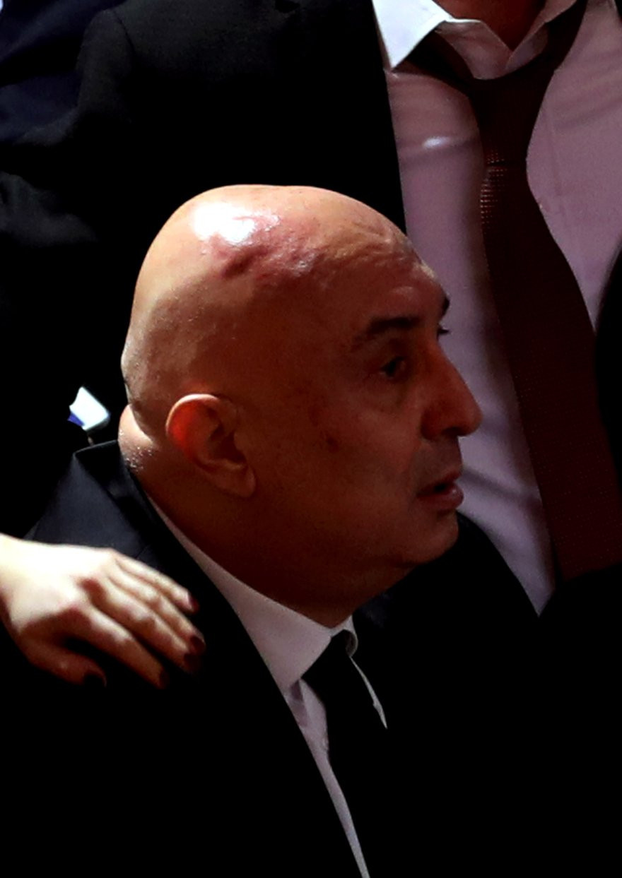 AKP'li vekillerin saldırısı sonrası Meclis'te çarpıcı görüntü - Resim : 2