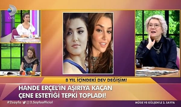 Hande Erçel'in 8 yıl önceki hali sosyal medyayı salladı! - Resim : 1