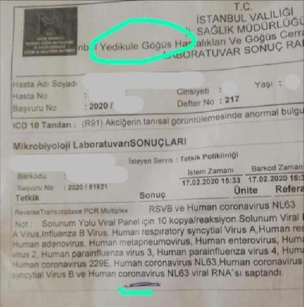 Sağlık Bakanı Fahrettin Koca'dan İstanbul'daki 'koronavirüs' iddiaları hakkında açıklama - Resim : 1