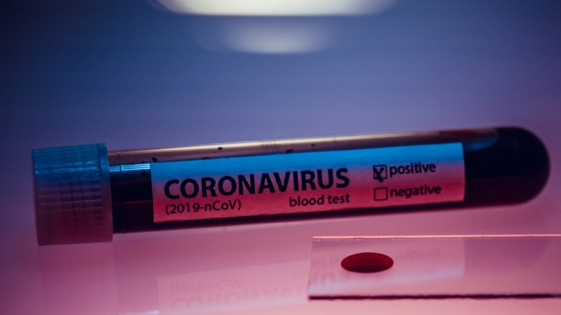 Türkiye'de ikinci koronavirüs vakası!