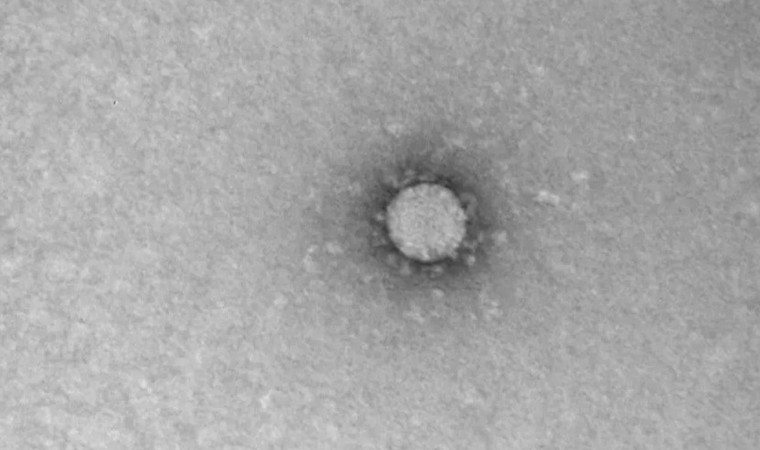 Rus bilim insanları koronavirüsün ilk mikroskop görüntülerini çekti - Resim : 1