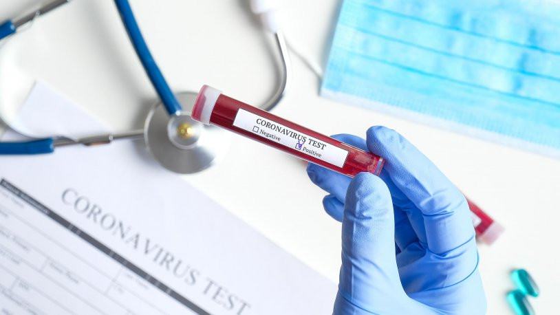 Sağlık Bakanlığı 'koronavirüs olası vaka' tanımına yeni madde ekledi