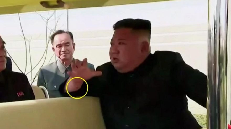 20 gün sonra ortaya çıkan Kim Jong-un’un fotoğrafında ilginç detay - Resim : 1