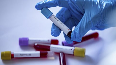 Türkiye'de koronavirüsten hayatını kaybeden kişi sayısı 5 bin 150'ye yükseldi
