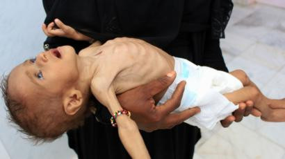 Las Vegas kumarhaneleri, Yemen'de çocukları açlıktan öldüren BAE Veliaht Prensi sayesinde açılıyor! - Resim : 1