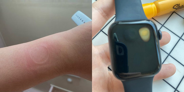 Uygun fiyatlı Apple Watch modelinde can sıkan sorun - Resim : 1