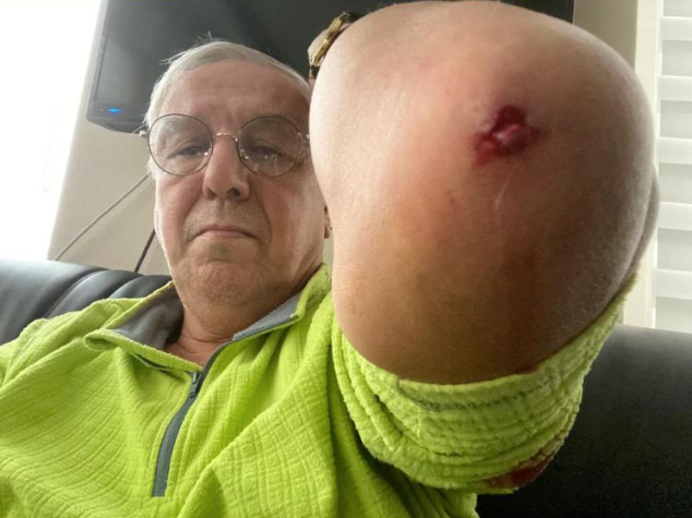 Gazeteci Orhan Uğuroğlu'na saldırı - Resim : 1