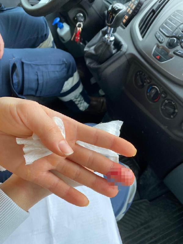 İhbarla eve gelen sağlık çalışanına saldırı: Parmaklarını ısırıp parçaladı! - Resim : 1