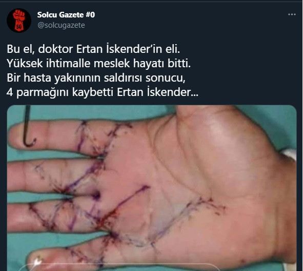 Doktor Ertan İskender'in eli saldırıdan sonra bu hale geldi! - Resim : 2