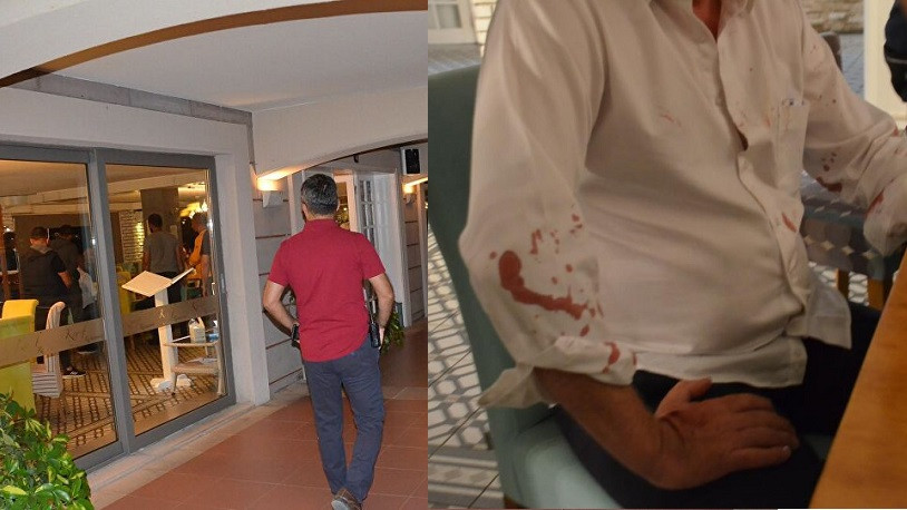 Didim Belediye Başkanı Deniz Atabay'a beyzbol sopalı saldırı!