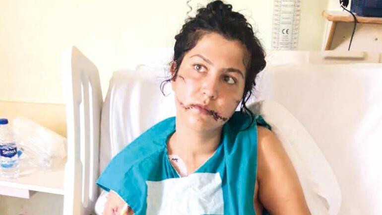 İzmir'de kan donduran vahşet! Birlikte yaşadığı kadını 104 yerinden bıçakladı - Resim : 1