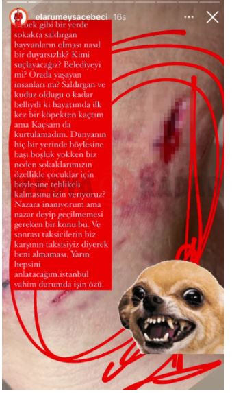 Sunucu Ela Rumeysa Cebeci'ye Bebek'te köpek saldırısı - Resim : 1