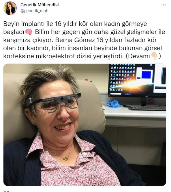 16 yıldır görmeyen kadın beyin implantı ile görmeye başladı! - Resim : 1