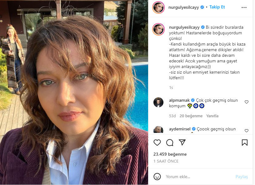 Nurgül Yeşilçay trafik kazası geçirdi: Ağzına ve çenesine dikişler atıldı - Resim : 1