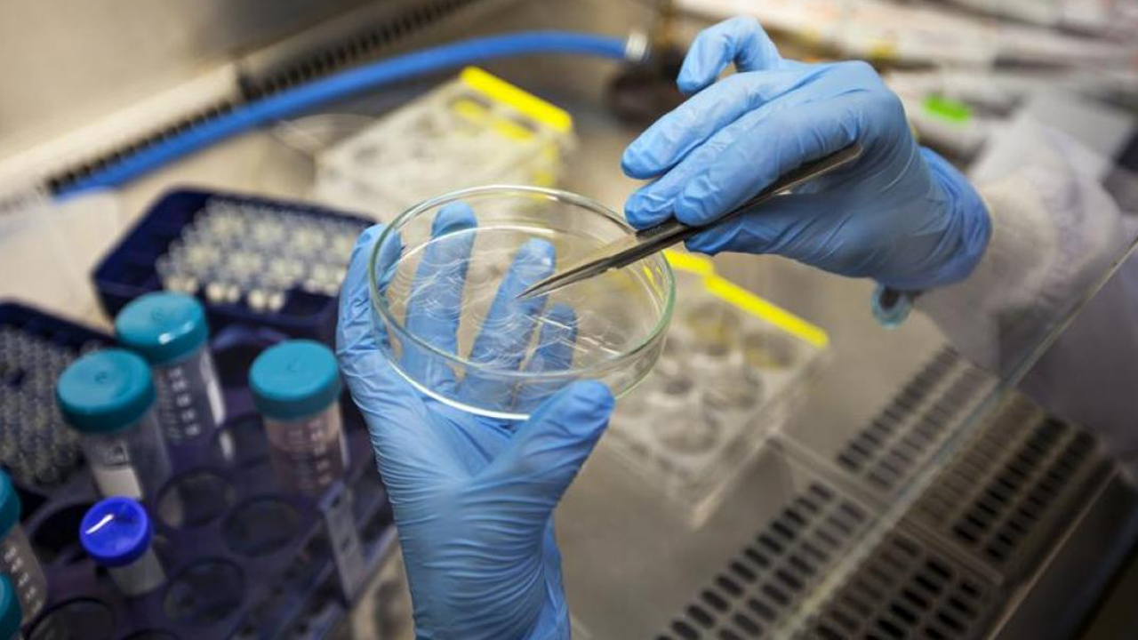 Yeni Salgın Kapıda! Türkiye’de de Görüldü, Belirtileri Grip ile Aynı… Test Yapılmadan Fark Edilmiyor - Resim : 3